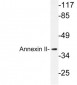 ANXA2 / Annexin A2 Antibody (aa88-137)